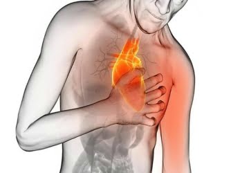 Infarto_cuore_web_2017