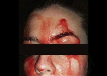 La_ragazza_che_suda_sangue_dagli_occhi