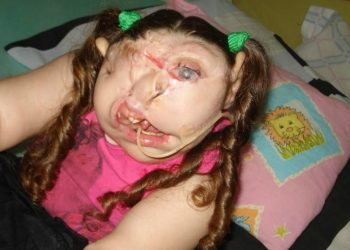 bambina-senza_volto_fb