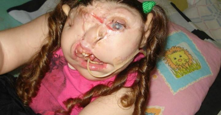 bambina-senza_volto_fb