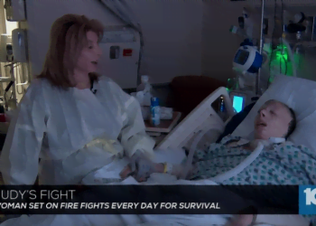 judy_bruciata_viva_canale8