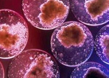 Pessina_17_00_439x302_okjpg