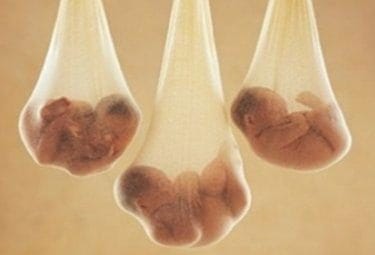 embrioR375_24mar09-1