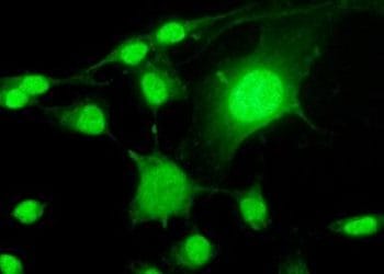 neuronitumoreR375_16feb10