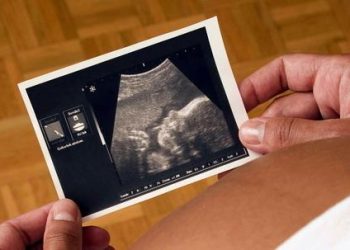 ecografia_gravidanza_phixr
