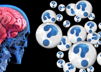 La malattia di Alzheimer