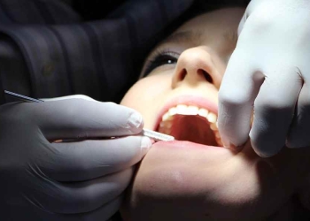 Problemi ai denti e legame con malattie cerebrali