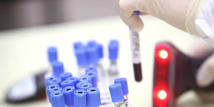 Ticket sanitario aumento spese