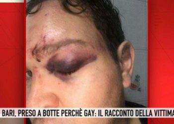 Picchiato perchè gay, Storie Italiane