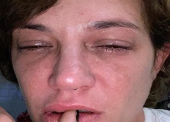 Asia Argento choc su Instagram