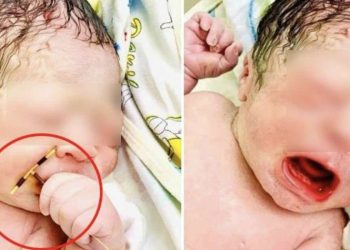 Il neonato nato stringendo la spirale della madre, foto Facebook