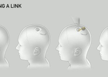 Neuralink Elon Musk: microchip
