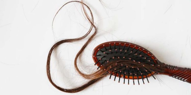 Perdita capelli, Pixabay