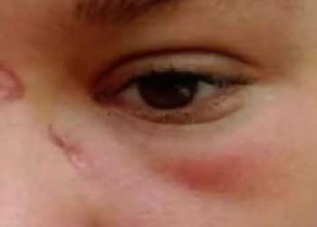 La foto della gelataia aggredita pubblicata dalla madre su Facebook