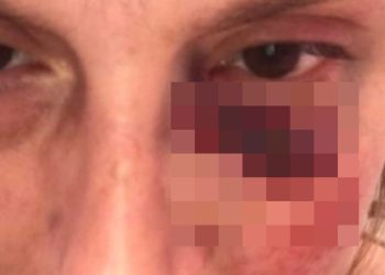 Professoressa aggredita in strada (foto: Facebook)