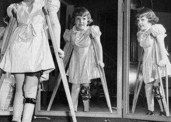 focolaio Poliomielite