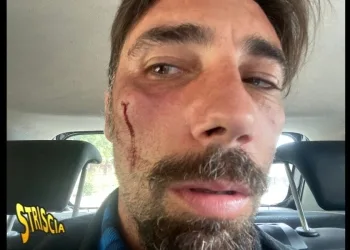 Vittorio Brumotti picchiato a Foggia (Striscia la Notizia)