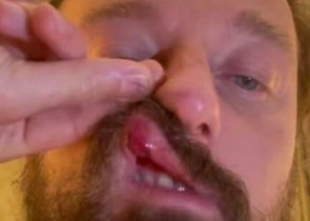 Francesco Facchinetti picchiato Conor McGregor