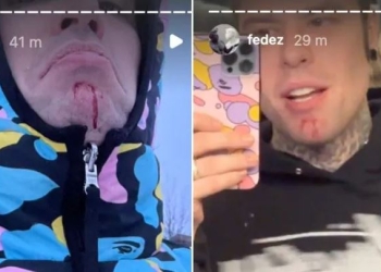 Fedez,, incidente sulle nevi (Instagram)