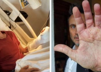 Nek e l'incidente alla mano