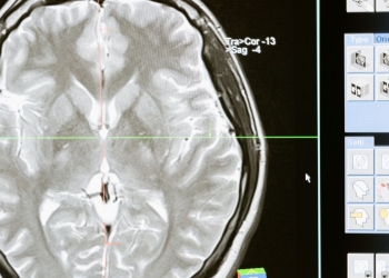 Nuovo studio: mettersi le dita nel naso aumenta il rischio di contrarre Alzheimer (Pexels)