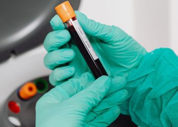 Globuli rossi prodotti in laboratorio trasfusi in pazienti umani (Pexels)