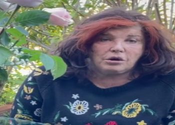 Patrizia De Blanck, la malattia al viso. (Foto: Web)