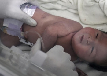 La figlia di Afraa ormai al sicuro nell'ospedale di Afrin, Siria (LaPresse)