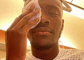 Tammy Abraham mostra l'occhio ferito su Instagram