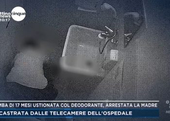 Il caso della bimba di 17 mesi ustionata con lo spray dalla madre a Mattino5