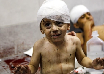 Bambini palestinesi nell'Ospedale al Shifa di Gaza (LaPresse)