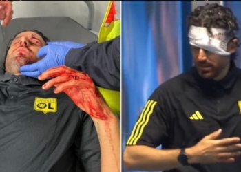 Fabio Grosso ferito sul pullman del Lione preso a sassate