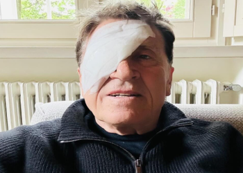 Gianni Morandi occhio benda (fonte Instagram)