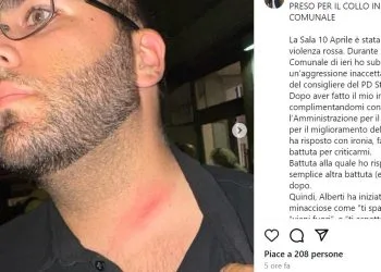 Filippo Frugoli mostra i segni via Instagram