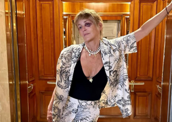 Sharon Stone con occhio nero