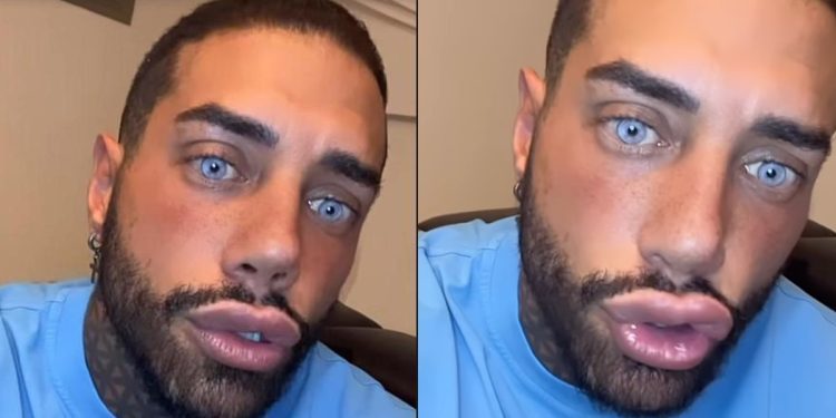 Francesco Chiofalo colore occhi