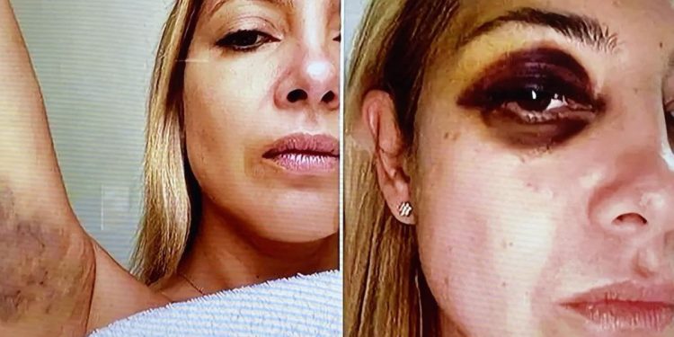 Fabiola Yáñez contro il marito Alberto Fernandez