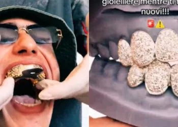 Achille Costacurta mostra i denti in diamante