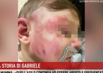 Gabriele, il bimbo di 14 mesi picchiato all'asilo di Palmi