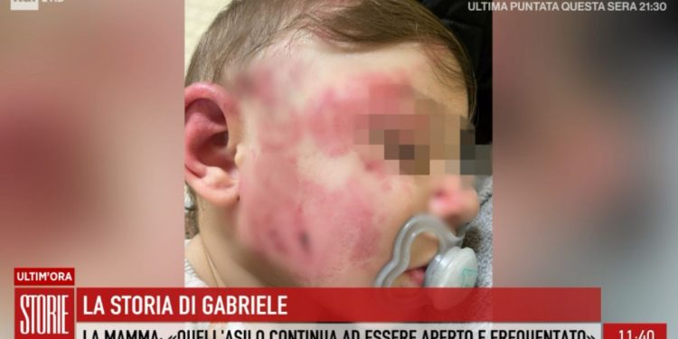 Gabriele, il bimbo di 14 mesi picchiato all'asilo di Palmi