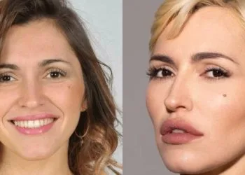 Serena Brancale, prima e dopo