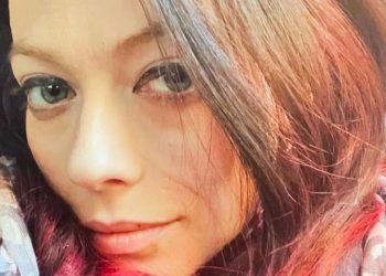 Michelle Trachtenberg morta perché ha fatto trapianto (Screen Foto: Instagram)
