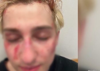 Federico, vittima della rapina finita a martellate in testa (Foto TgCom24)