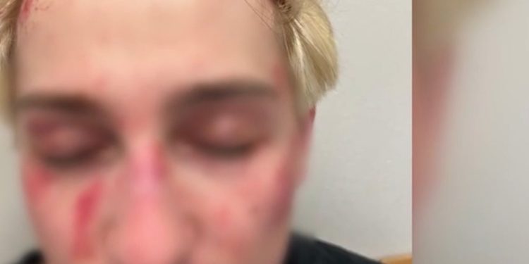 Federico, vittima della rapina finita a martellate in testa (Foto TgCom24)