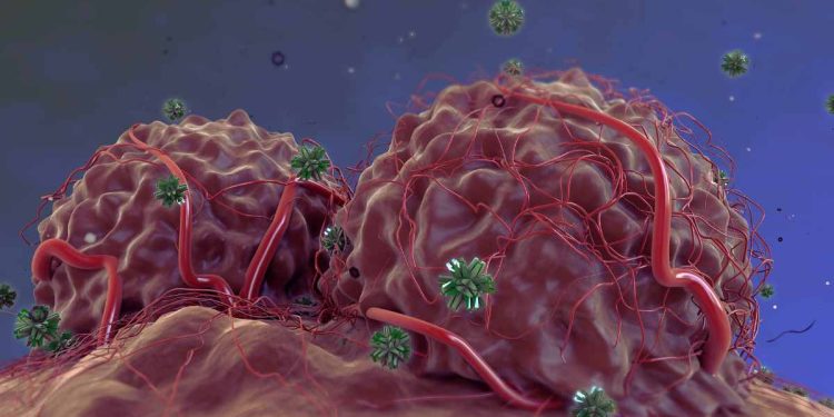 Differenza tra cancro e tumore