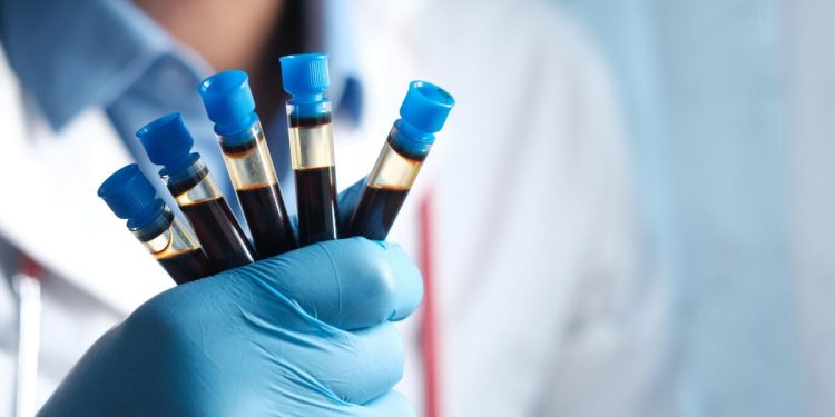 che cos'è test genetico oncologico