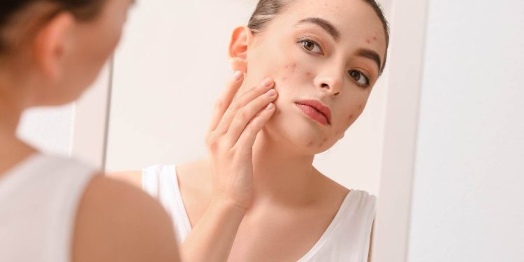 cosa succede se non ti lavi