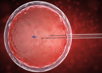 Fecondazione in vitro
