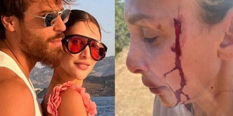 Can Yaman e la fidanzata Sara Bluma foto choc