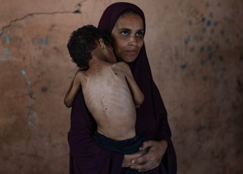 I segni della fame sulla popolazione di Gaza (Ansa)